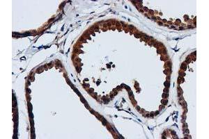 Immunohistochemical staining of paraffin-embedded Human breast tissue using anti-GATM mouse monoclonal antibody. (GATM Antikörper)