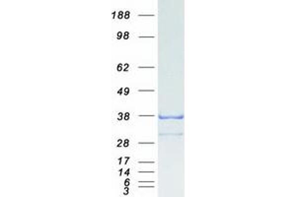 GID4 Protein (Myc-DYKDDDDK Tag)