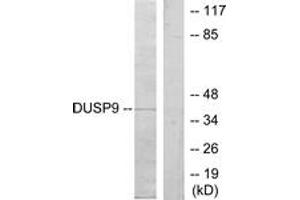 Western blot analysis of extracts from HeLa cells, using DUSP9 Antibody. (DUSP9 Antikörper  (AA 151-200))