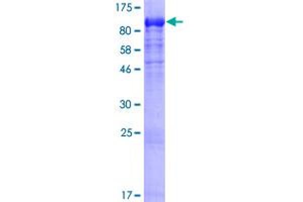 DYNC1I1 Protein (AA 1-628) (GST tag)