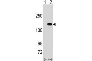 Western Blotting (WB) image for anti-Pumilio Homolog 2 (Drosophila) (PUM2) antibody (ABIN3003295) (PUM2 Antikörper)