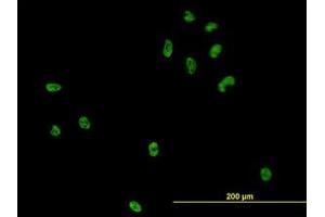 Image no. 2 for anti-CSE1 Chromosome Segregation 1-Like (CSE1L) (AA 872-972) antibody (ABIN465994)
