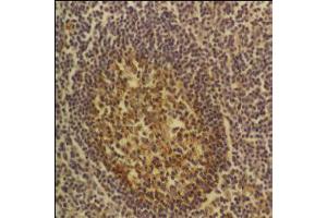 CD54 – ABIN118785 - Tonsil. (ICAM1 Antikörper)