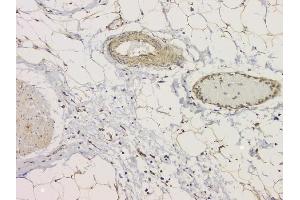 IHC analysis of SRCIN1 using anti-SRCIN1 antibody (ABIN6719623). (SRCIN1 Antikörper  (AA 189-287))