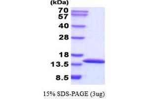 SDS-PAGE (SDS) image for Cystatin A (Stefin A) (CSTA) (AA 1-98) (Active) protein (His tag) (ABIN6387718)
