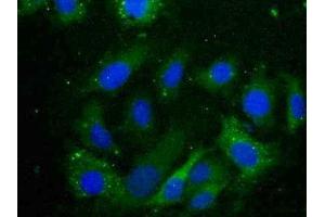 Detection of CRYaB in Human U2OS Cell using Polyclonal Antibody to Crystallin Alpha B (CRYaB) (CRYAB Antikörper  (AA 1-175))