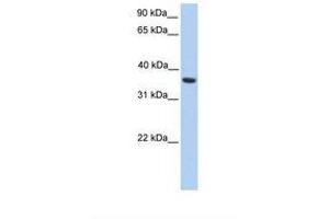 Image no. 1 for anti-Melanoma Antigen Family A, 4 (MAGEA4) (C-Term) antibody (ABIN6738943)