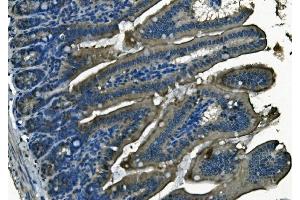 IHC analysis of PI-16/PI16 using anti-PI-16/PI16 antibody (ABIN7601074). (PI16 Antikörper  (AA 28-363))