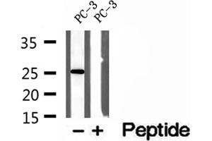 Western blot analysis of extracts of PC-3 cells, using OIP5 antibody. (OIP5 Antikörper  (C-Term))