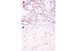 Immunohistochemical analysis of paraffin-embedded human ovarian cancer (A) and brain tissue (B) using PRKAA1 monoclonal antobody, clone 2B7  with DAB staining. (PRKAA1 Antikörper)