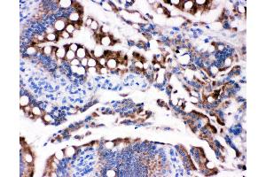 Anti-HSD17B2 antibody,  IHC(P) IHC(P): Rat Intestine Tissue (HSD17B2 Antikörper  (C-Term))