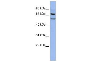 FOXRED1 antibody used at 1 ug/ml to detect target protein.