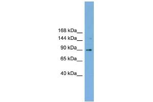 WB Suggested Anti-TACC3 Antibody Titration: 0. (TACC3 Antikörper  (Middle Region))