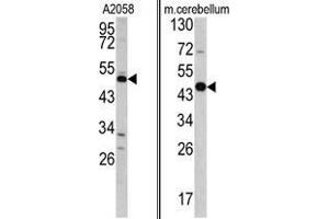 (LEFT) Western blot analysis of GAS7 antibody (C-term) in A2058 cell line lysates (35 µg/lane). (GAS7 Antikörper  (C-Term))