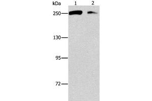Western Blot analysis of Lovo and 293T cell using EIF4G1 Polyclonal Antibody at dilution of 1:450 (EIF4G1 Antikörper)