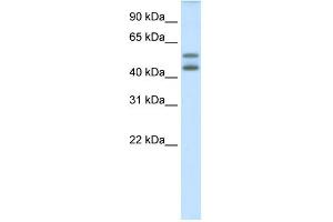 WB Suggested Anti-IRF5 Antibody Titration:  0. (IRF5 Antikörper  (N-Term))