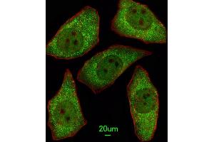 Immunofluorescent analysis of A549 cells, using MSRA Antibody (N-term) (ABIN391489 and ABIN2841456). (MSRA Antikörper  (N-Term))