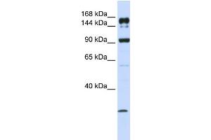 WB Suggested Anti-ABCA5 Antibody Titration:  1 ug/ml  Positive Control:  MCF-7 whole cell lysates (ABCA5 Antikörper  (C-Term))