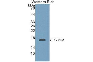 Western Blotting (WB) image for anti-alpha-2-Glycoprotein 1, Zinc-Binding (AZGP1) (AA 180-298) antibody (ABIN1171666)