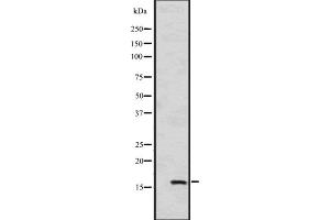 Western blot analysis of HSPB9 expression in A549 cell line lysates ,The lane on the left is treated with the antigen-specific peptide. (HSPB9 Antikörper  (C-Term))