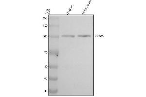 Western blot analysis of PDE2A using anti-PDE2A antibody (ABIN7605887).