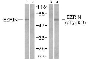 Western blot analysis of extracts from A431 cells, untreated or EGF-treated (200ng/ml, 30min), using Ezrin (Ab-353) antibody (E021094, Lane 1 and 2) and Ezrin (phospho-Tyr353) antibody (E011063, Lane 3 and 4). (Ezrin Antikörper  (pTyr353))