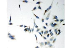 ICC testing of NOX5 antibody and HeLa cells (NOX5 Antikörper  (C-Term))