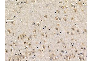 MEK1 Mouse Monoclonal Antibody at 1/100 staining mouse brain tissue by IHC-P.