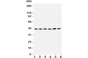 Western blot testing of TRAM antbody;  Lane 1: rat brain;  2: (r) kidney;  3: human 293T;  4: (h) Raji;  5: (h) Jurkat cell lysate.