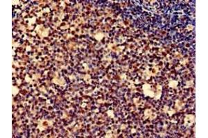 Immunohistochemistry of paraffin-embedded human tonsil tissue using ABIN7162722 at dilution of 1:100 (PDLIM2 Antikörper  (AA 161-284))
