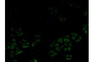 Detection of SMN in Human Hela Cells using Polyclonal Antibody to Survival Motor Neuron Protein (SMN) (SMN1 Antikörper  (AA 2-294))