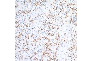 Immunohistochemistry (IHC) image for anti-Arginase, Liver (ARG1) (AA 1-322) antibody (ABIN7454020) (Rekombinanter Liver Arginase Antikörper  (AA 1-322))