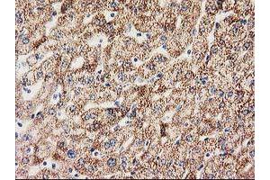 Immunohistochemical staining of paraffin-embedded Human liver tissue using anti-MMAB mouse monoclonal antibody. (MMAB Antikörper)
