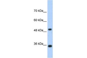 Western Blotting (WB) image for anti-Fructose-1,6-Bisphosphatase 1 (FBP1) antibody (ABIN2462400) (FBP1 Antikörper)
