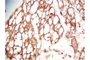 Mouse visceral fat tissue was stained by Rabbit Anti-Cathepsin S (298-331) (Human) Serum (Cathepsin S Antikörper  (AA 298-331))