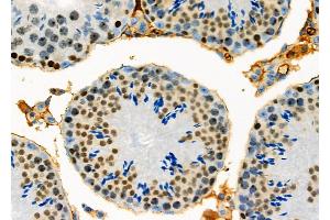 ABIN6261387 and ABIN6278336 at 1/100 staining Mouse testis tissue by IHC-P.
