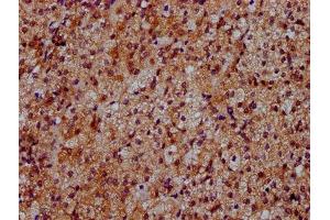 IHC image of ABIN7150800 diluted at 1:500 and staining in paraffin-embedded human adrenal gland tissue performed on a Leica BondTM system.