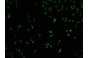 Immunofluorescence staining of SH-SY5Y cells with ABIN7152090 at 1:100, counter-stained with DAPI. (ELF2 Antikörper  (AA 1-353))