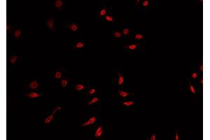 ABIN6269136 staining A549 cells by IF/ICC. (FGFR1 Antikörper  (C-Term))