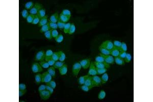 IF analysis of MPI using anti-MPI antibody (ABIN7600514). (MPI Antikörper  (AA 2-99))