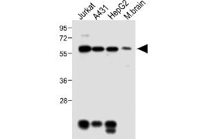 All lanes : Anti-MeCP2 Antibody at 1:2000 dilution Lane 1: Jurkat whole cell lysate Lane 2: A431 whole cell lysate Lane 3: HepG2 whole cell lysate Lane 4: Mouse brain lysate Lysates/proteins at 20 μg per lane. (MECP2 Antikörper  (AA 400-428))
