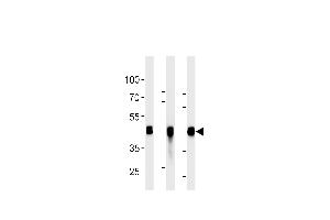 All lanes : Anti-CYK18 Antibody (C-term) at 1:2000 dilution Lane 1: HepG2 whole cell lysates Lane 2: K562 whole cell lysates Lane 3: NCI- whole cell lysates Lysates/proteins at 20 μg per lane. (Cytokeratin 18 Antikörper)