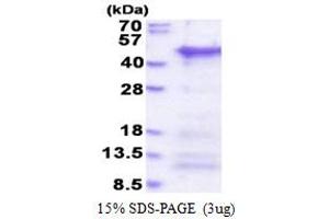 Coiled-Coil Domain Containing 69 (CCDC69) (AA 1-296) protein (His tag)