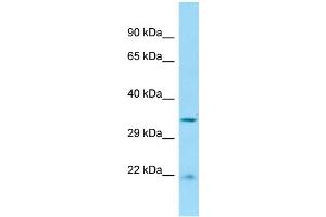 WB Suggested Anti-RGD1306739 Antibody Titration: 1. (Cabcoco1 Antikörper  (C-Term))