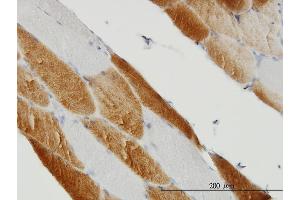 Immunostaining (ISt) image for anti-Succinate Dehydrogenase Complex, Subunit C, Integral Membrane Protein, 15kDa (SDHC) (AA 1-169) antibody (ABIN562832)