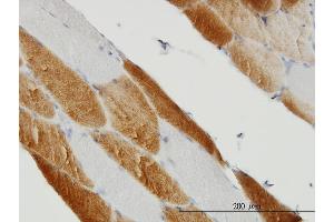 Immunoperoxidase of monoclonal antibody to SDHC on formalin-fixed paraffin-embedded human skeletal muscle. (SDHC Antikörper  (AA 1-169))