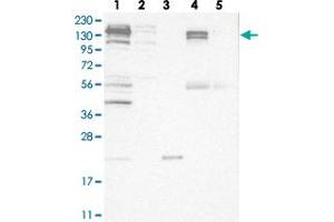 Western blot analysis of Lane 1: RT-4, Lane 2: U-251 MG, Lane 3: Human Plasma, Lane 4: Liver, Lane 5: Tonsil with CGN polyclonal antibody  at 1:250-1:500 dilution. (Cingulin Antikörper)
