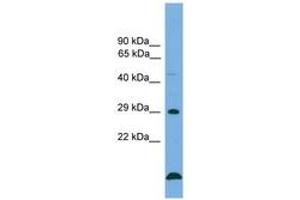 Image no. 1 for anti-B-Cell CLL/lymphoma 2 (BCL2) (AA 85-134) antibody (ABIN6745511) (Bcl-2 Antikörper  (AA 85-134))
