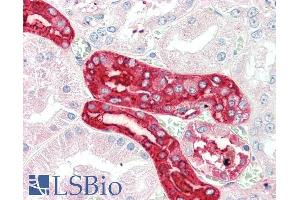 ABIN5539884 (5µg/ml) staining of paraffin embedded Human Kidney. (MEX3C Antikörper  (AA 541-554))