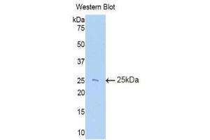 Western Blotting (WB) image for anti-TIMP Metallopeptidase Inhibitor 3 (TIMP3) (AA 27-209) antibody (ABIN1860762) (TIMP3 Antikörper  (AA 27-209))